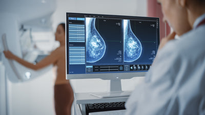 Are Mammograms the Key to Beating Breast Cancer? What Every Woman Over 40 Must Know