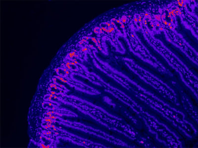 Nicotinamide Mononucleotide: A Potential Key to Mitigating Intestinal Stem Cell Aging in Mice