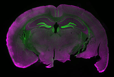 Revitalizing Brain Health with NMN in Diabetic Rodents: A Protective Shield for Neurons